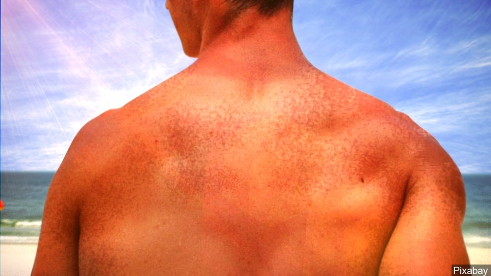 Nevada ranked among states with lowest rate of skin cancer - News3LV thumbnail